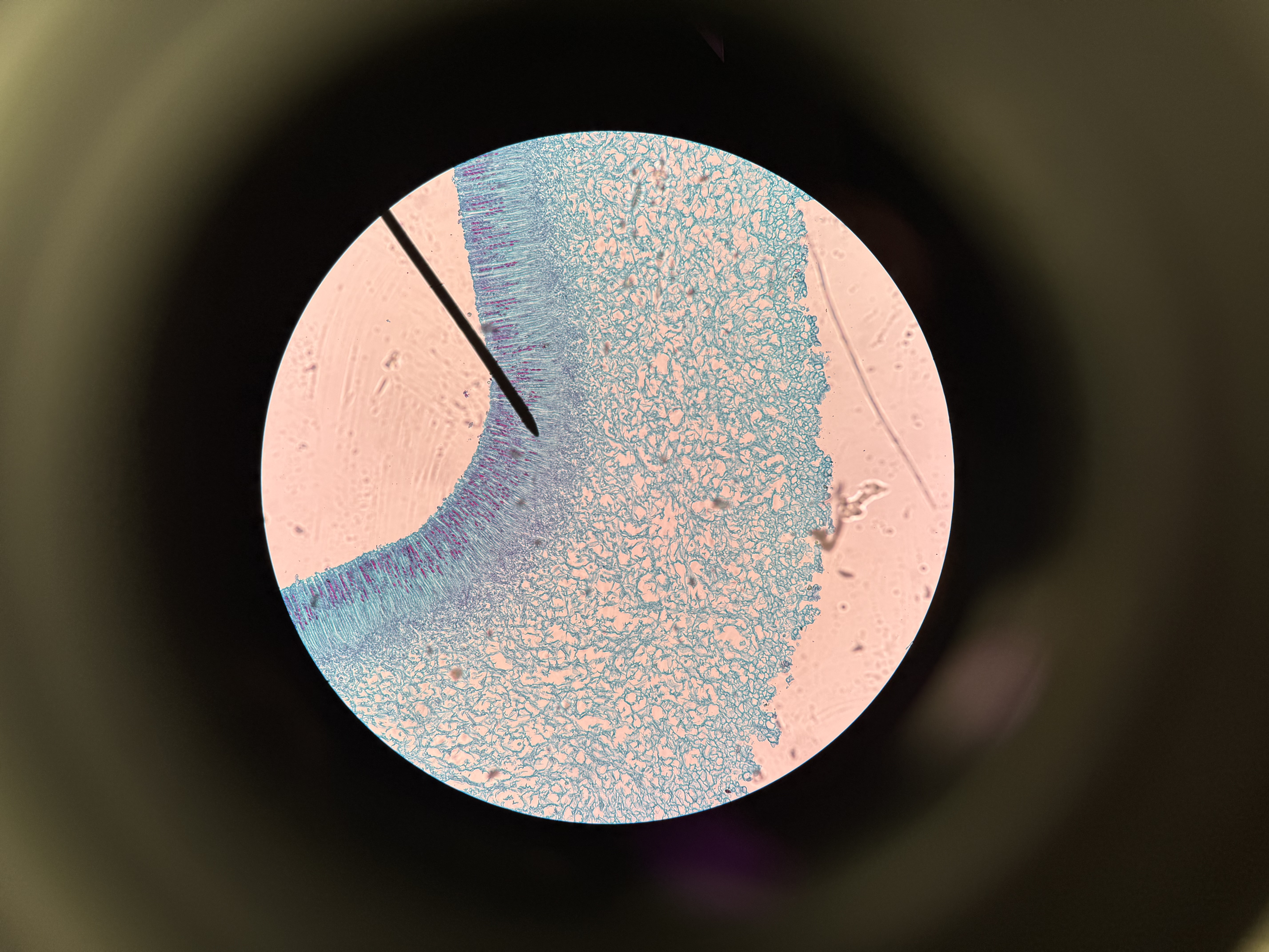 <ol><li><p>What is this?</p></li><li><p>What phylum?</p></li><li><p>Spore location?</p></li><li><p>What type of fungi?</p></li><li><p>Where is the ascocarp?</p></li><li><p>What is the asci?</p></li><li><p>What is the ascopores?</p></li><li><p>What is the hyphae?</p></li></ol><p></p>