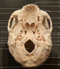 <p>What structure is #8? (Fig. 3.8 Cranium, Inferior View)</p>