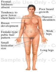 <p>- Small/firm testes in males with atrophy in seminiferous tubules</p><p>- Low testosterone/delayed puberty</p><p>- Gynecomastia</p><p>- Female pubic hair pattern // Reduced facial and body hair</p><p>- Micropenis</p><p>- Long legs and arms</p>