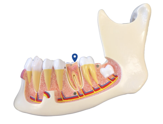 <p>Which tooth type is best shaped for grinding?</p>