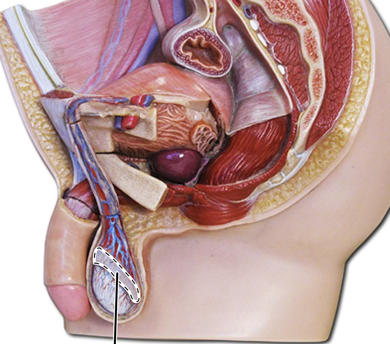 term image