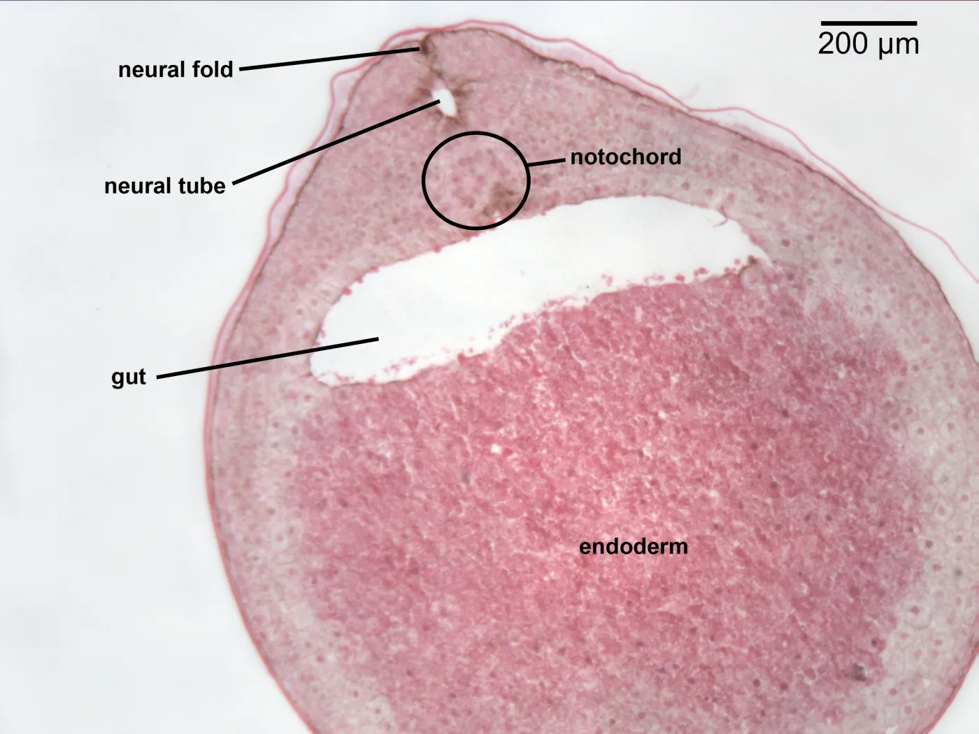 <p> neural tube.</p>