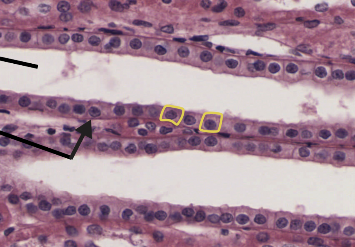 <p>This is a histology of what epithelium ?</p>