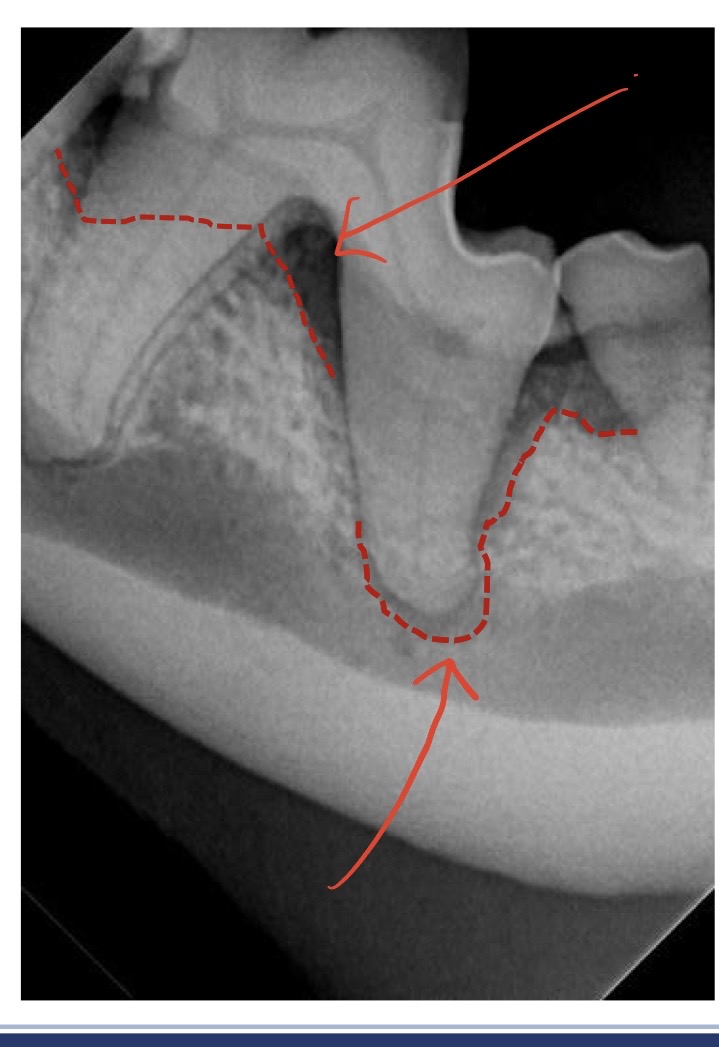<p>what is the bottom arrow pointing to?</p>