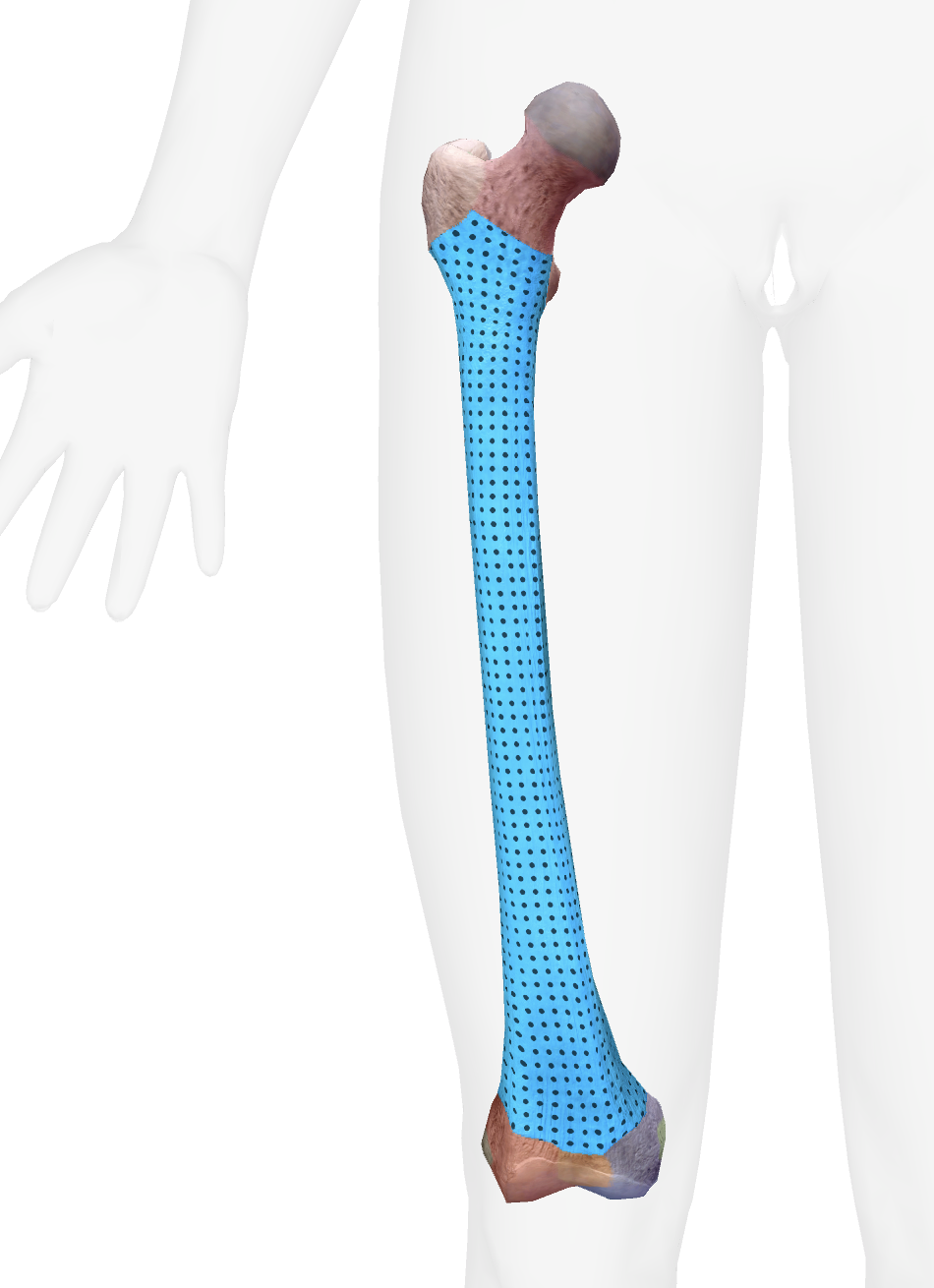 <p>What is this part of the femur </p>