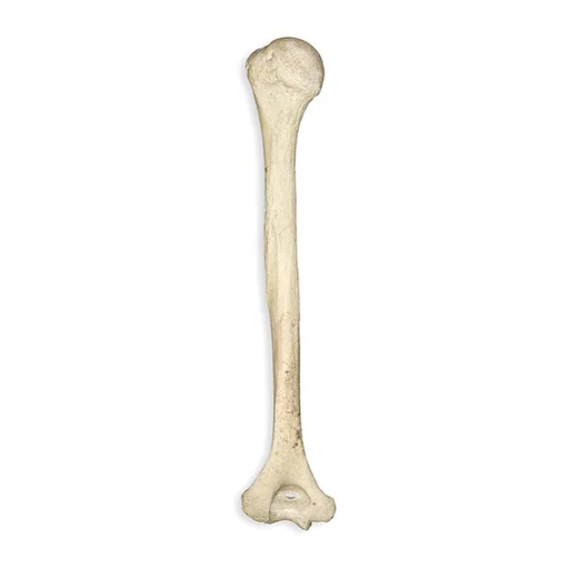 <p>Identify this bone</p>