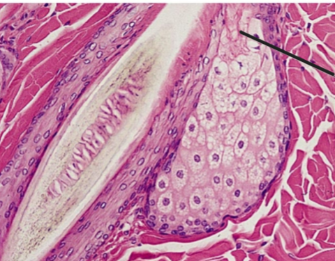<p>What is the black line pointing to? What is the overall picture?</p>