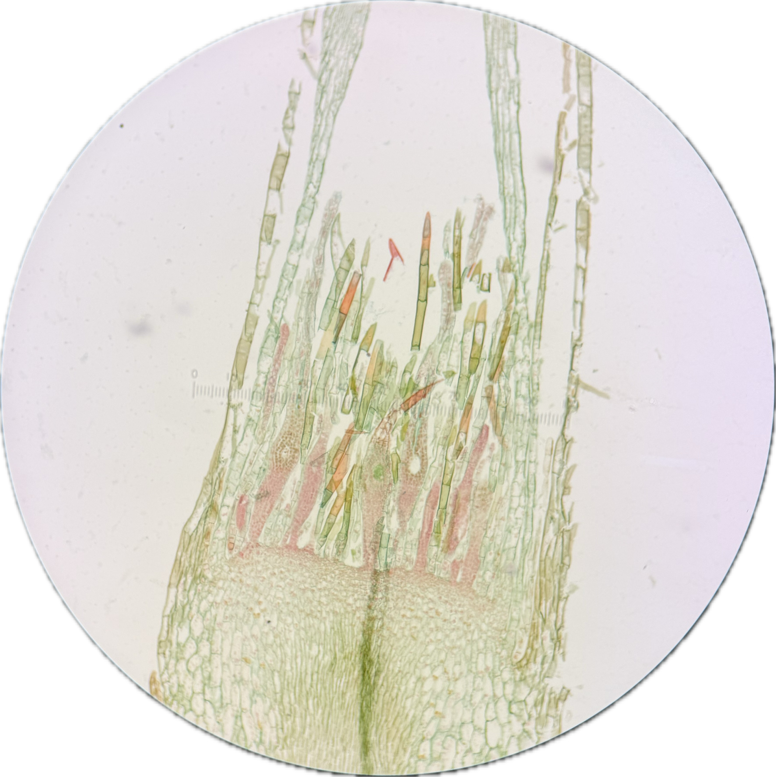 <p>This WHOLE structure is called the and its part of </p>