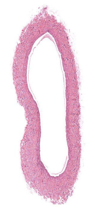 <p>Identify what is pictured?</p>