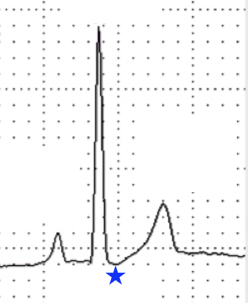 <p>What wave is indicated by the blue star?</p>