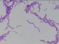 <p>Gram stain</p>