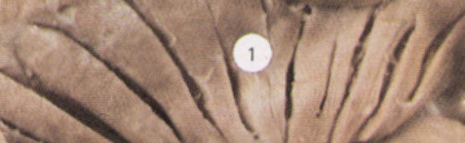 <p>Name the muscle</p>
