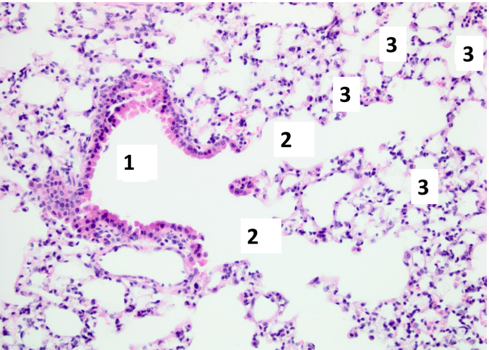 <p>Name the structure indicated by 3.</p>