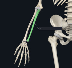 <p>Name the bone marked by the X highlighted green</p>