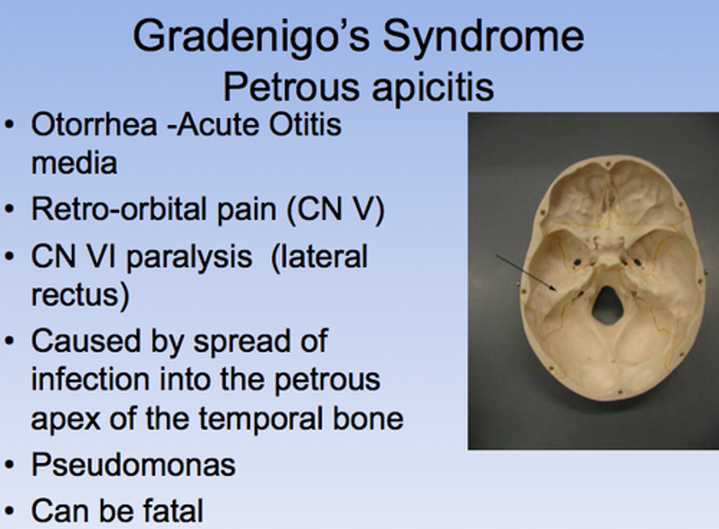 <p>a group of symptoms including ear pain, discharge from the ear that hurts and double vision.</p>