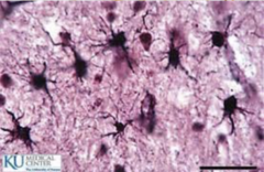 <p>- Provide structural and metabolic support for neurons.</p><p>- Form blood brain barrier</p><p>*Star Shaped*</p>