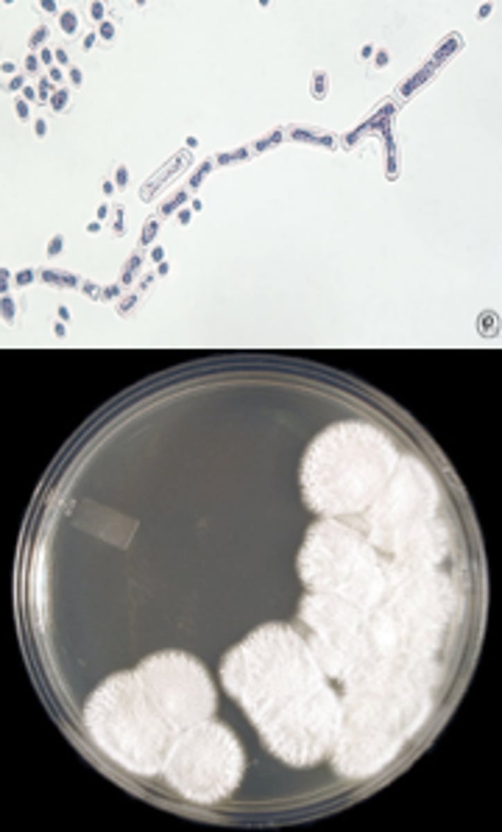 <p>Rectangular</p><p>Wide, septate, hyaline</p><p>True hyphae with lateral branching</p><p>Arthroconidia break off hyphae</p><p>Free arthroconidia germinate from one corner</p><p>No blastoconidia or pseudohyphae</p>