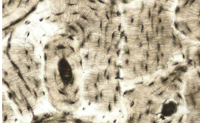<ul><li><p><span style="background-color: transparent; font-family: "Playfair Display", serif;">Hard, calcified matrix (osteons) with peripheral osteocytes (black dots)</span></p></li><li><p><span style="background-color: transparent; font-family: "Playfair Display", serif;">“Tree ring” pattern</span></p></li><li><p><span style="background-color: transparent; font-family: "Playfair Display", serif;">Support and protection</span></p></li></ul><p></p>