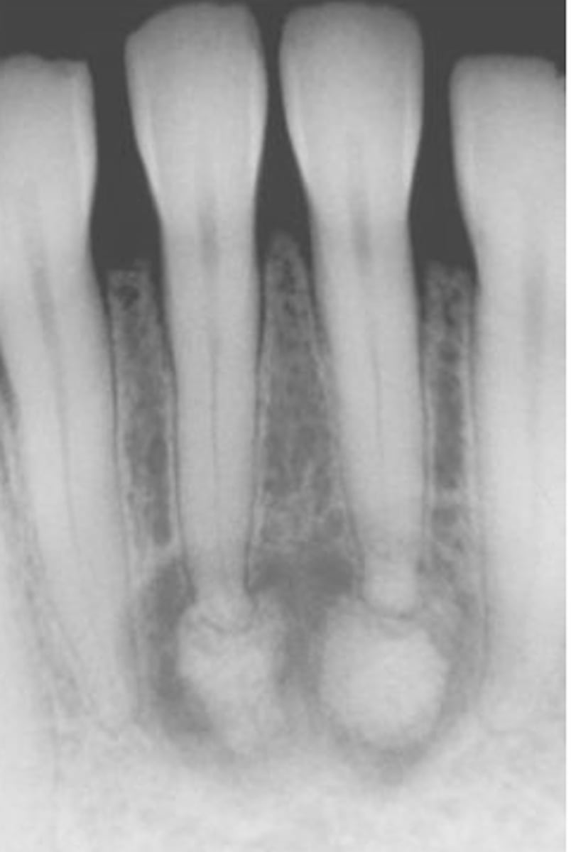 <p>Taken to see the whole tooth from the crown to the apex</p>