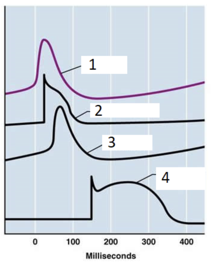 <p><span>The picture shows four time traces corresponding to different heart locations: SA node, AV node, atrial muscle and ventricular muscle. Which one corresponds to the ventricular muscle?</span></p>