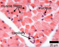<p>What type of muscle tissue is this?</p>