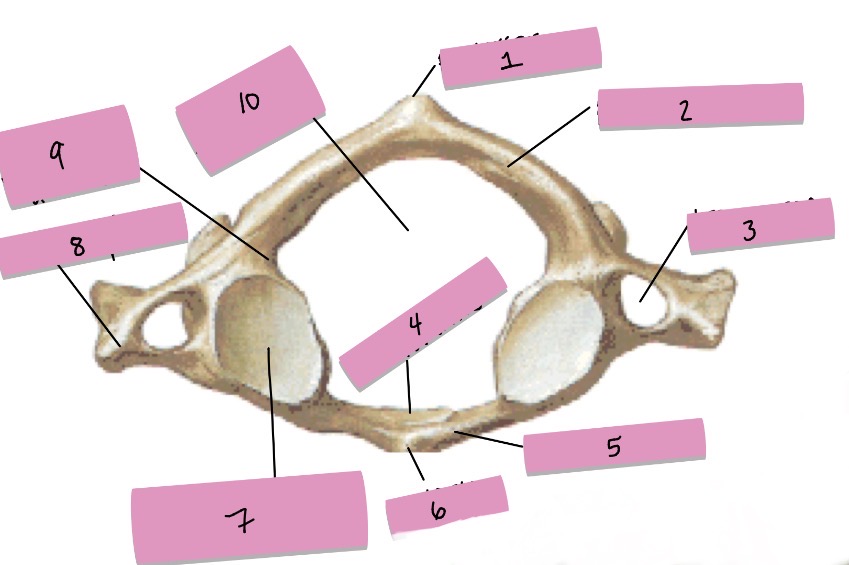 <p>What is 4 pointing to?</p>