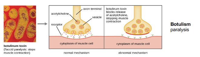 <ol><li><p><strong>Botulinum toxin blocks </strong>the <strong>release </strong>of <strong>acetylcholine</strong>, <strong>stopping muscle contraction</strong>, leading to <strong>Botulism paralysis</strong></p></li></ol><p></p>