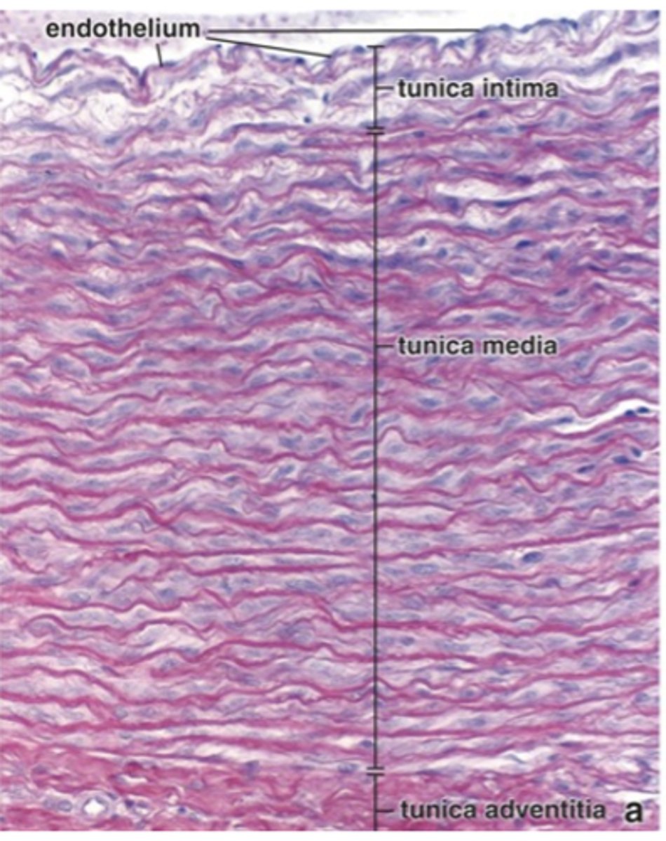 <p>Identify the type of vessel</p>