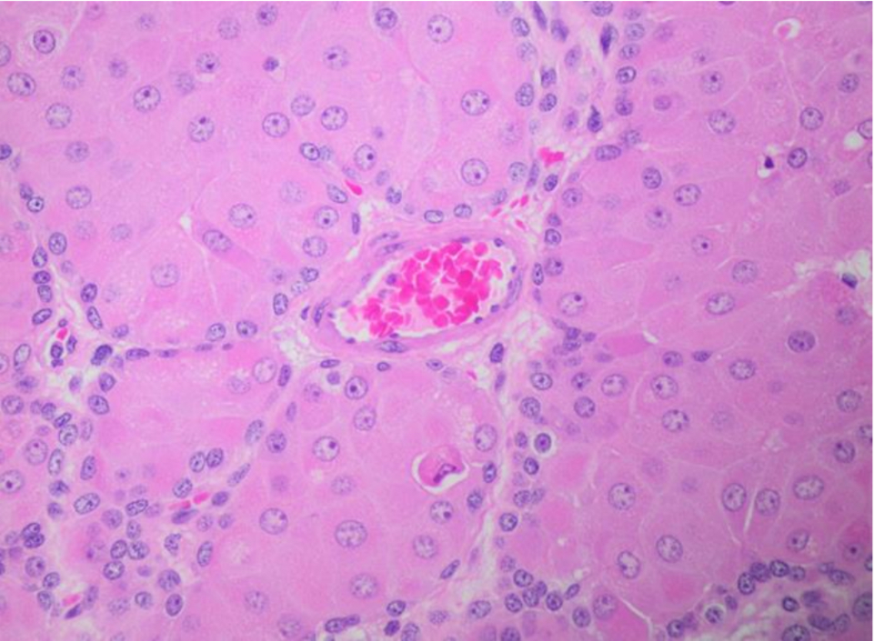 <p>What type of gland is represented in the picture?</p>