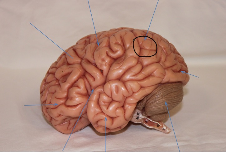 <p>Identify the circled area?</p>