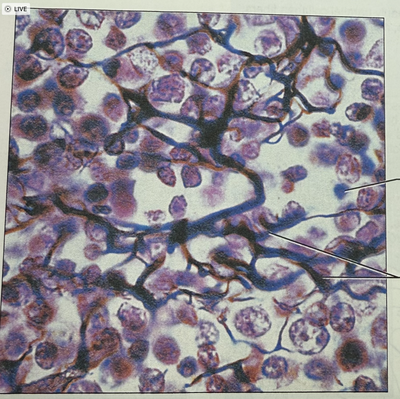 <p>what tissue is this</p>