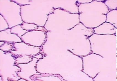 <p>what tissue type is this</p>