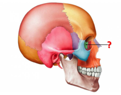 <p>Identify this bone.</p>