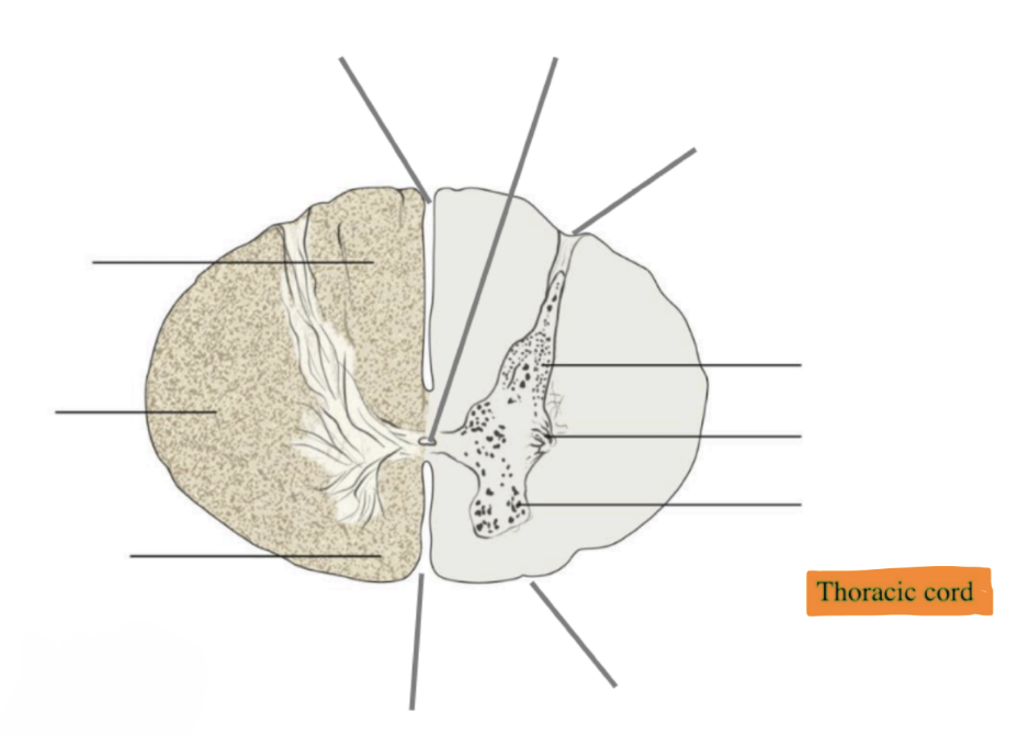 <p>Label this cross sectional image of the spinal cod in the thoracic region. </p>