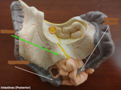 <p>What structure is the green arrow pointing to?</p>