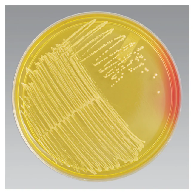 <p>What is the observation and Conclusion of this agar plate?</p>