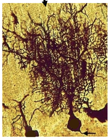 <p>Purkinje Cell</p>