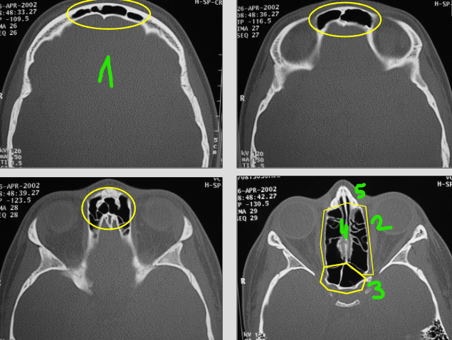 term image
