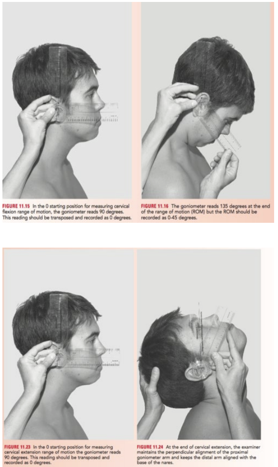 <p>The goniometer's axis (fulcrum) is aligned with the external auditory meatus (ear canal), the stationary arm is perpendicular to the ground (either up or down), and the moving arm aligns with the base of the nose.</p>