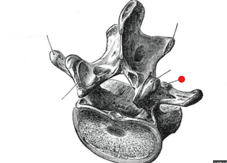 <p>Identify the structure pinned </p>