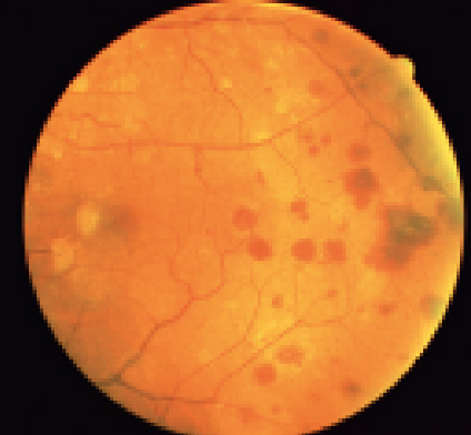 term image
