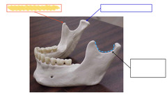 <p>Mandible</p>