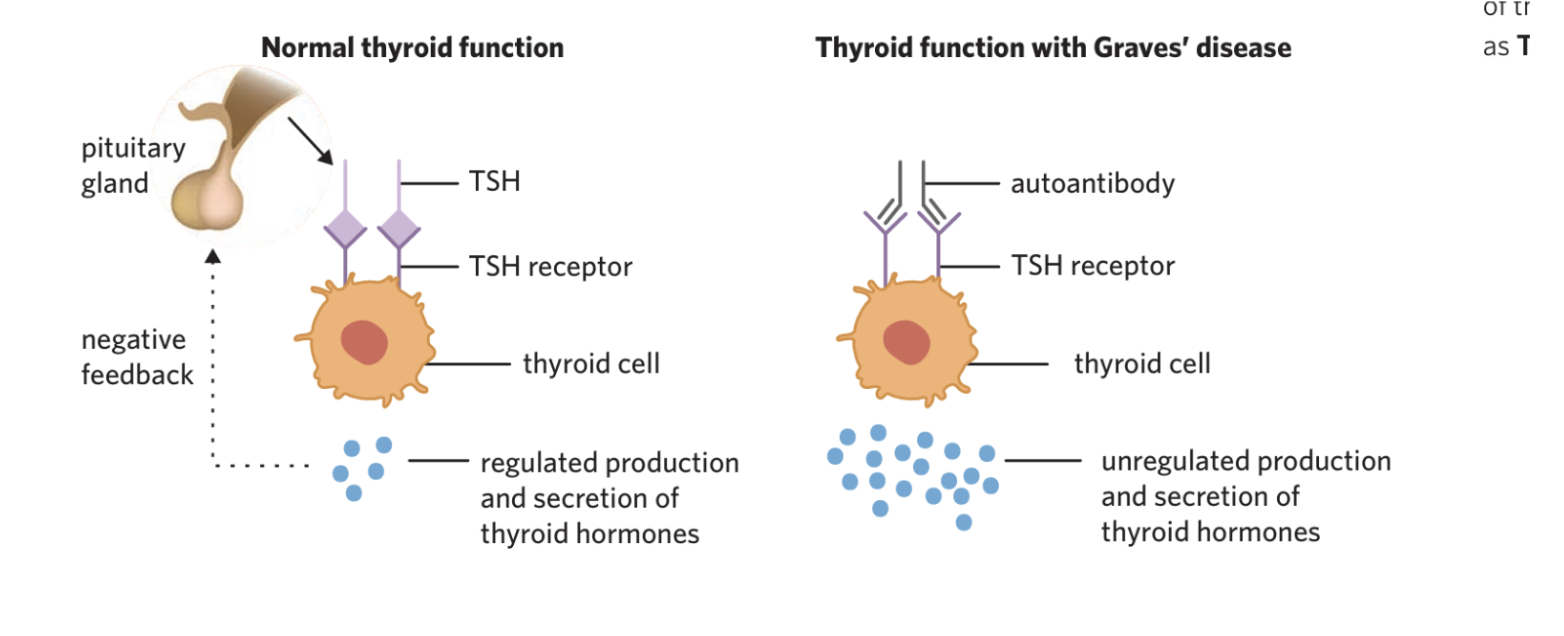 <p><span style="background-color: transparent;">-The immune system  produces an autoantibody called thyroid-stimulating immunoglobulin (TSI)</span></p><p><span style="background-color: transparent;">-antibody recognises and binds to the TSH receptors on the thyroid, stimulating the thyroid to release T3 and T4</span></p><p><span style="background-color: transparent;"><strong>Leads to </strong></span></p><p><span style="background-color: transparent;">-elevated levels of thyroid hormones</span></p><p><span style="background-color: transparent;">-constant stimulation to release hormones</span></p><p></p><p></p>