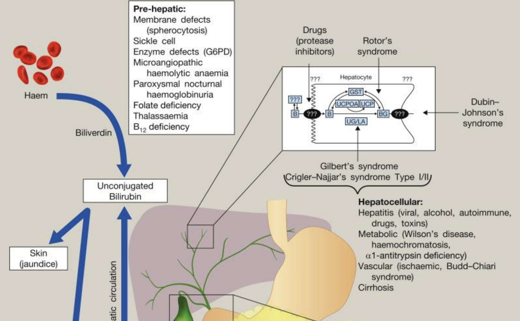 <p>gene mutation in Gilbert syndrome and Crigler-Najjar Syndrome</p>