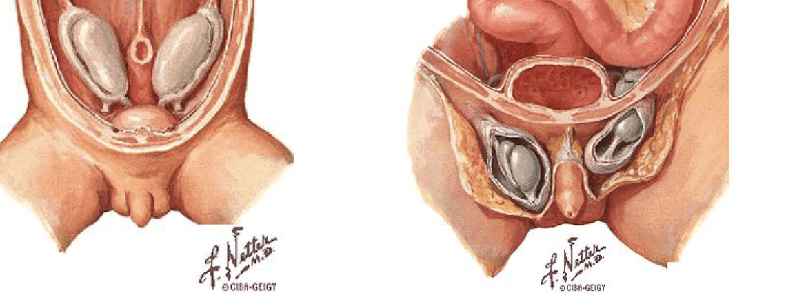 <ul><li><p>Passage connecting the abdomen to the scrotum.</p></li><li><p>Testes develop in the abdomen, before traveling down the <strong>deep inguinal ring (entrance)</strong></p></li><li><p>It then exits from the inguinal canal through the <strong>superficial inguinal ring (exit)</strong></p></li></ul><p></p>