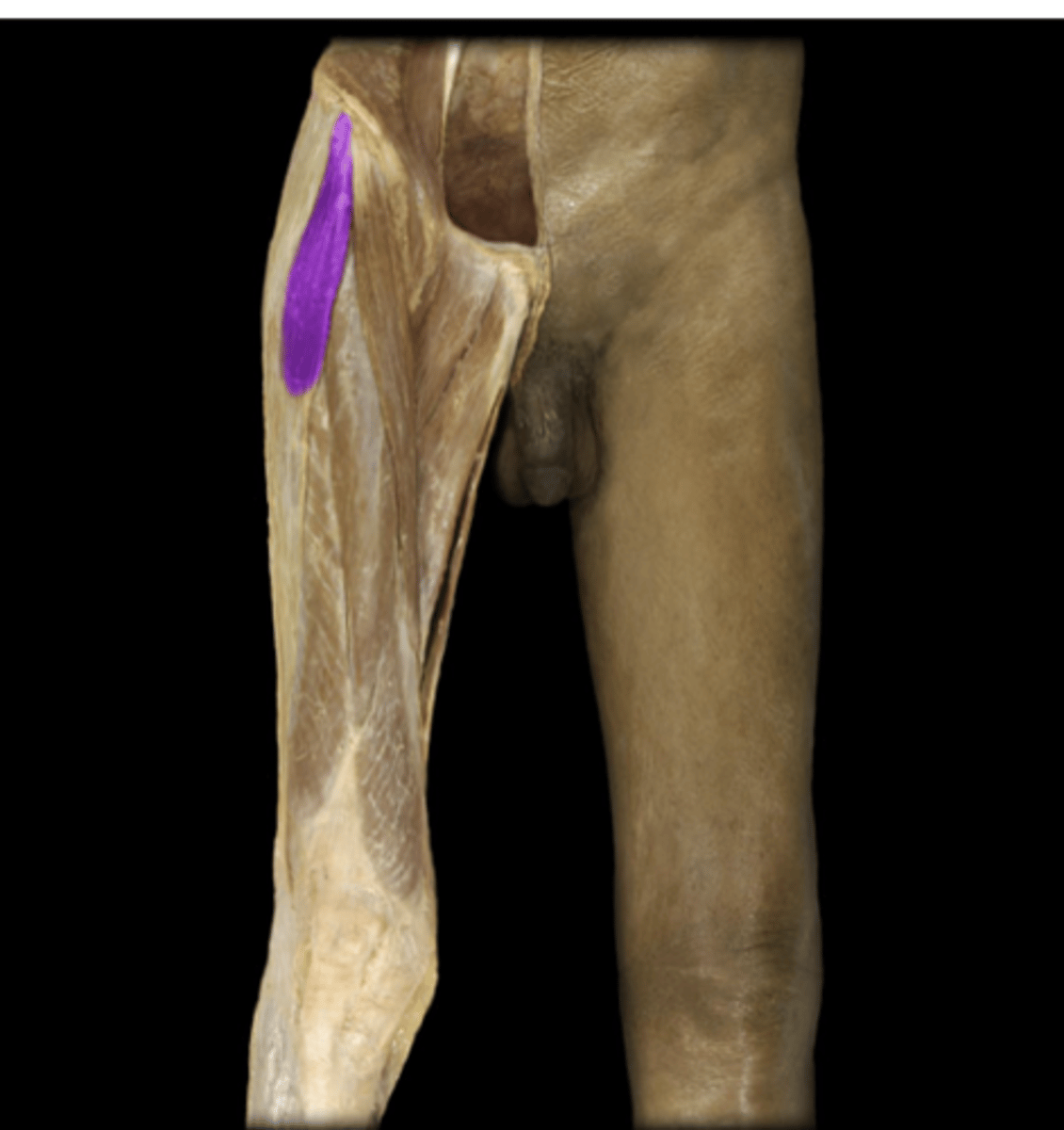 <p>What muscle is indicated in purple?**</p>