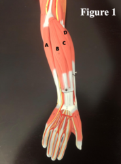 <p>What muscle is D?</p>