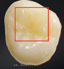 <p>What is the classification?</p>