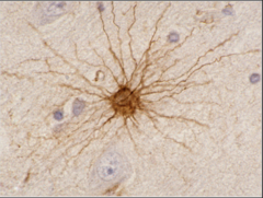 <p>What does this image show?</p>