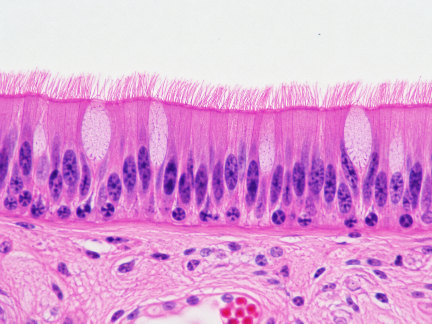 <p>What type of Epithelium Tissue is this ?</p>